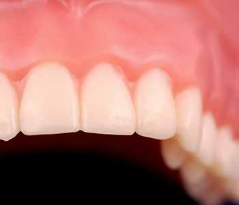 Dr Evans dentist offers mercury-safe dental care