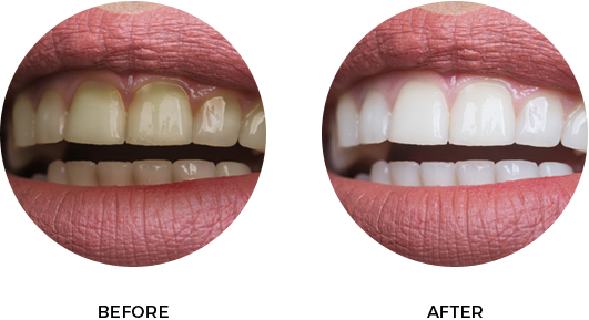 Before After Image 01