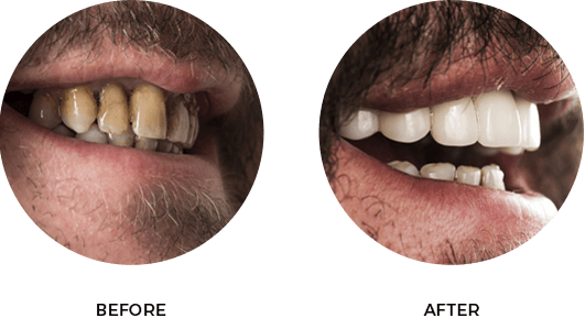 Before After Image 02