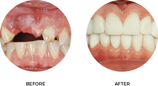 Before After Image 03