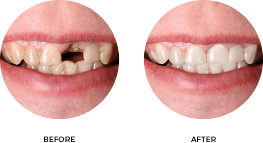 Before After Image 04