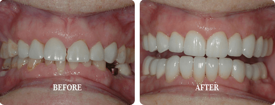 Before After Case 01