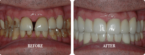 Before After Case 01