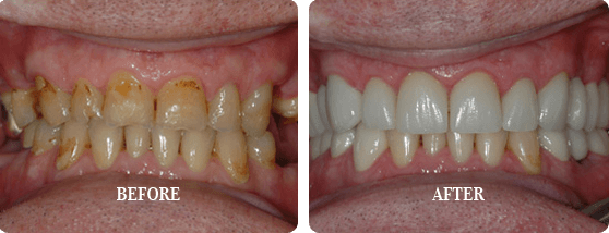 Before After Case 01