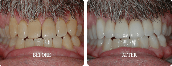 Before After Case 01