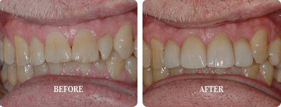 Before After Case 01