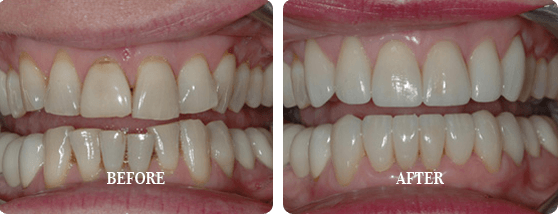 Before After Case 01