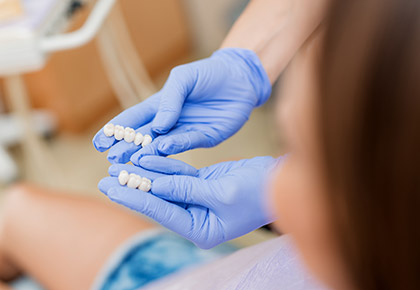 Veneers