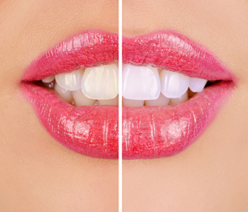 Dr E. Griffin Cole Explains How Four ways cosmetic dentistry improves oral health for Austin, TX patients
