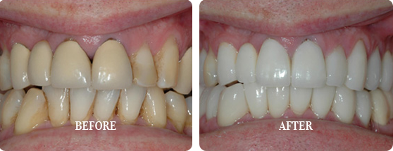 Before After Case 12