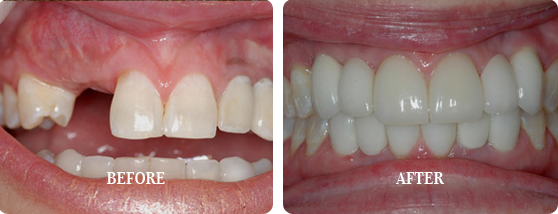 Before After Case 15