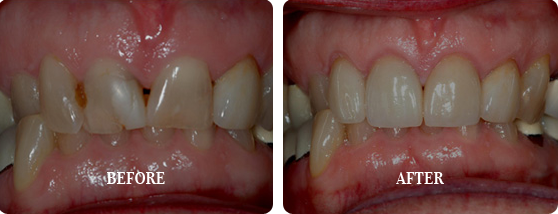 Before After Case 16