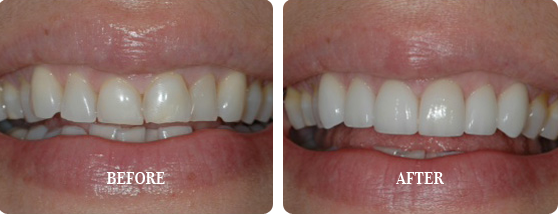 Before After Case 18