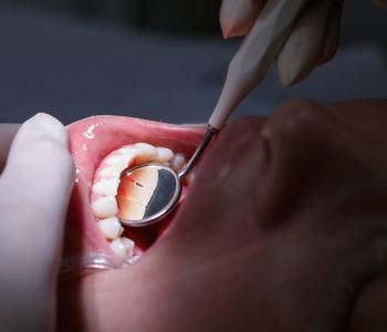 Austin, TX, dentist talks about gum disease treatment