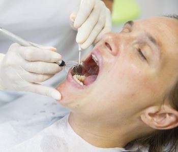The benefits of treating gum disease in the Austin office of your biological dentist
