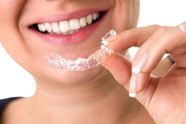Invisalign Braces