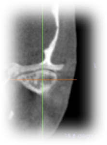 Orthodontics Before Case 7
