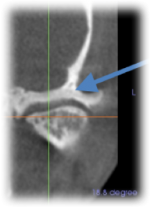 Orthodontics After Case 7