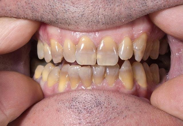 Before Image Case 9