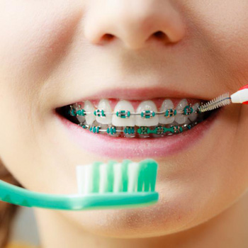 Children Orthodontics
