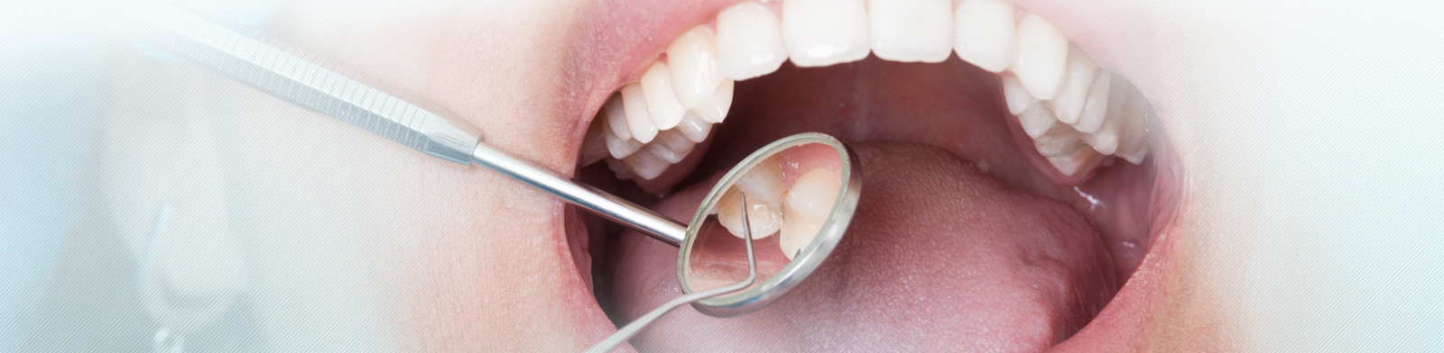 Dentist Tools and Mouth Open