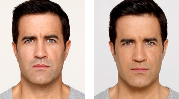 Before After Case - 2