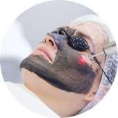 Laser Treatment