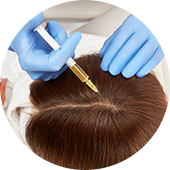 PRP Treatment