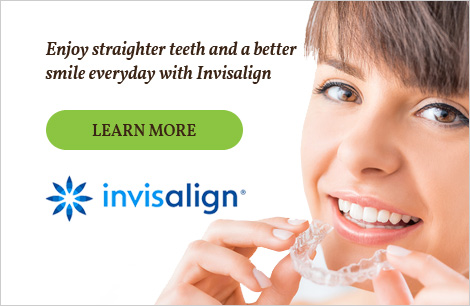 Invisalign Banner