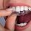 Keeping teeth straight and healthy in Mississauga
