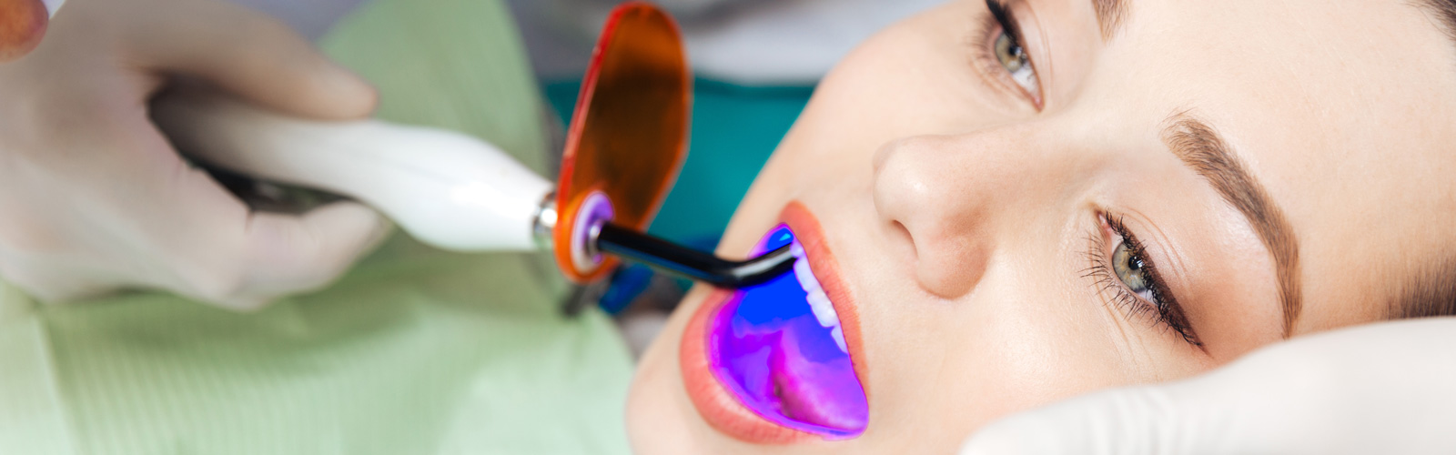 Woman getting done laser teeth whitening