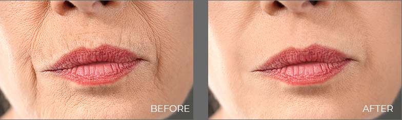 Gallery Before After 01