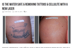Dr. Christine Lee was a guest on Health, Wealth & Wisdom radio show on 18th June 2014, She spoke about New Laser & Light Treatments for Cellulite, Fat, Tattoos, Wrinkles and Tightening.