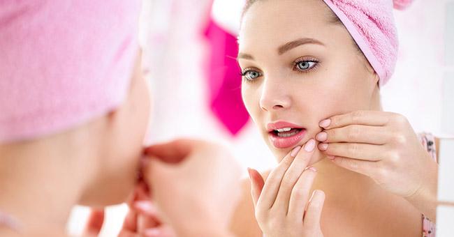 Acne, Walnut Creek