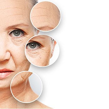 San Francisco area patients ask about non-invasive wrinkle correction with Juvéderm Voluma