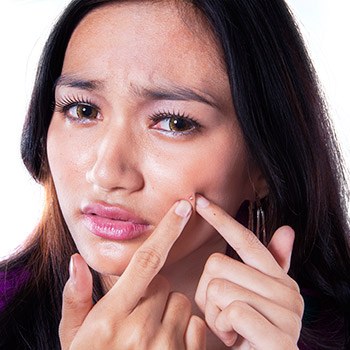 Dermatologist in San Francisco offers treatment for acne