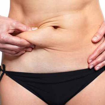 Enjoy non-invasive fat removal with Vanquish in Walnut Creek, CA