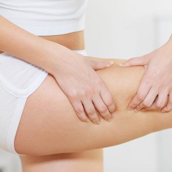 What is the Cellulaze all about? Ask a doctor at a local treatment center in Walnut Creek