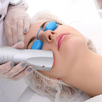 Bay area patients discover the CO2 laser for skin resurfacing