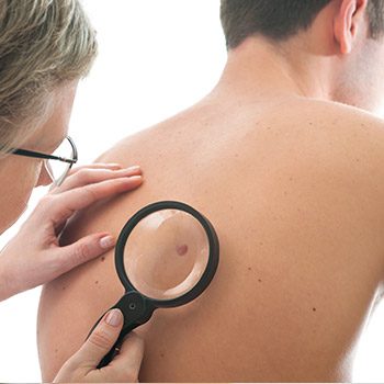 Can a doctor in Walnut Creek, CA cure skin cancer with surgery?