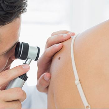 Lafayette area dermatologist describes Mohs micrographic surgery