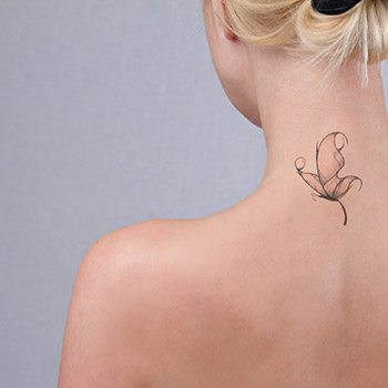 How to effectively remove tattoos in the Walnut Creek area