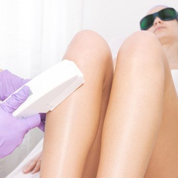 Is Laser Hair Removal Permanent?