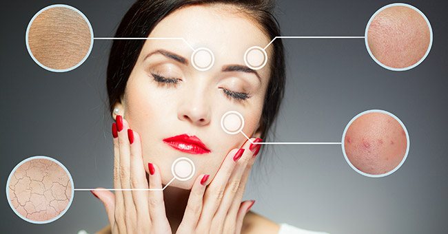 Microdermabrasion, Walnut Creek