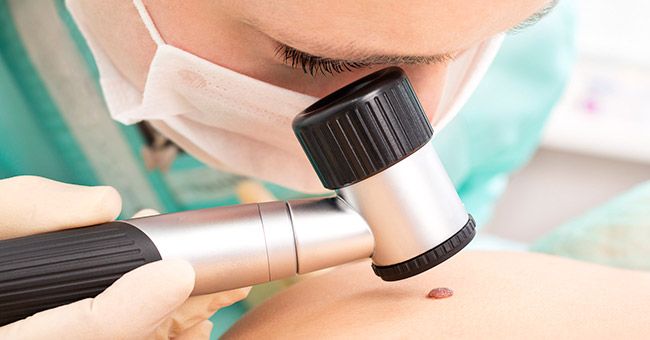 Mohs Micrographic Surgery, Walnut Creek