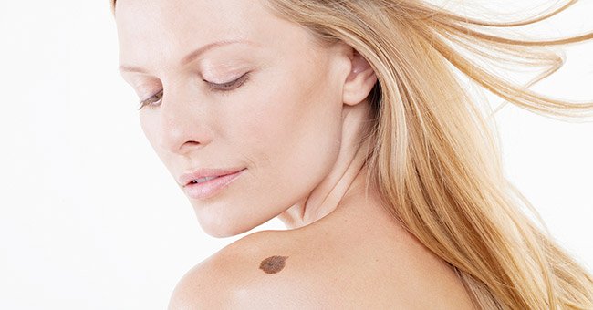Skin Cancer and Skin Surgery, Walnut Creek, California