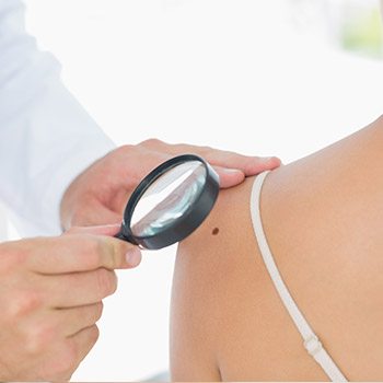 Specialists resolve concerning skin cancer symptoms in Walnut Creek