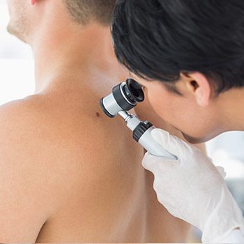 Walnut Creek, CA specialist discusses how symptoms vary by skin cancer type