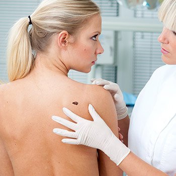 What is the treatment for patients in Walnut Creek to undergo in skin cancer dermatology?