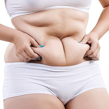 Who can benefit from SmartLipo in the Bay area?